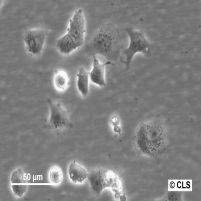 RPMI 2650细胞图片